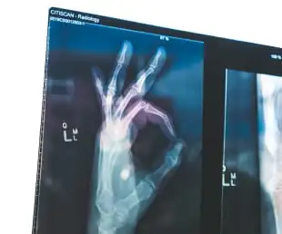 Страхование сотрудников